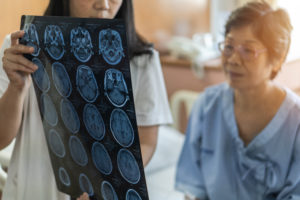 Doctor showing brain xray to a patient