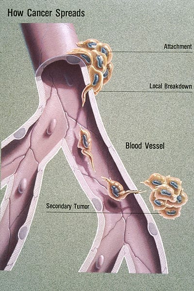 Treatment Prevents Tumor Growth In Mice