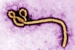 Ebola Case in Texas Result of Medical Negligence?