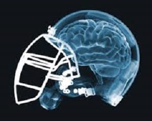 Football Player with Brain Damage Sues University for Medical Malpractice