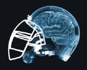 Football Player with Brain Damage Sues University for Medical Malpractice