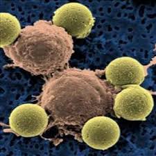 T-Cell Therapy & Curing Cancer